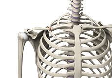 Clavicle Fracture and ORIF