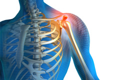 Shoulder Pain